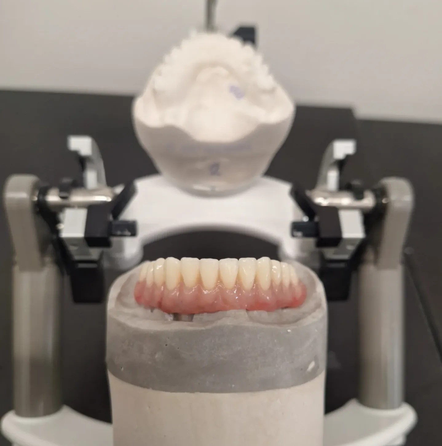 Lower arch on the articulator