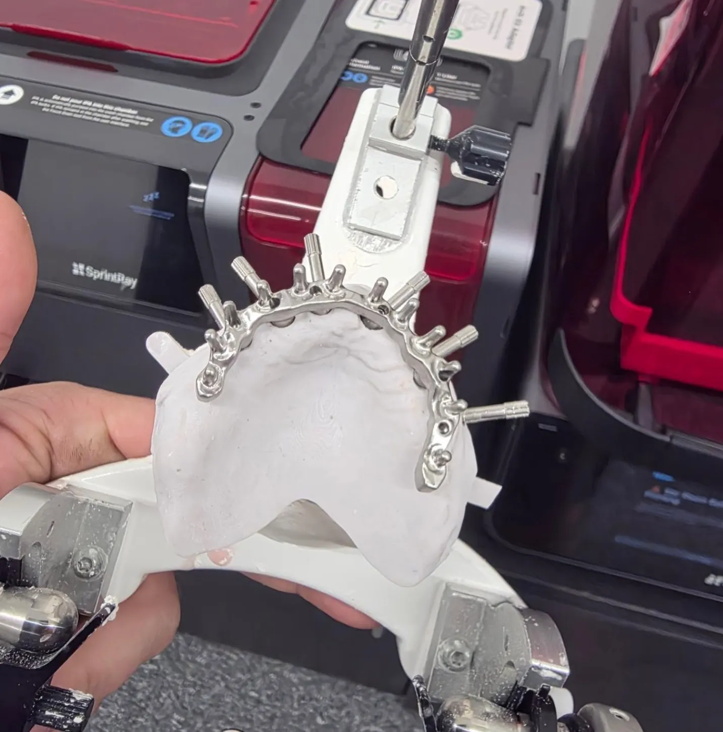 Milled implant bar seated on the model, checked by hand at the printer